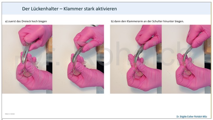 Kieferorthopädie für Hauszahnärzte